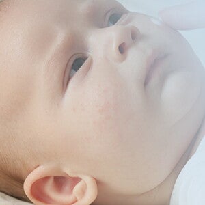 Baby allergies_02_LEARN_Ask the expert_01