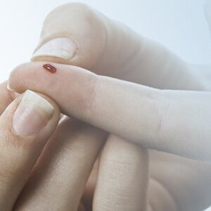 Gestational diabetes_01_EXPLORE_How to protect your baby