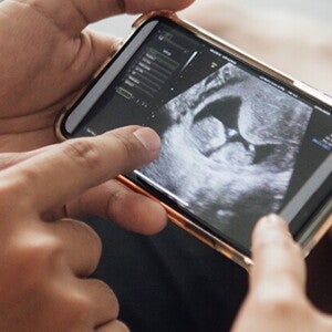 Questions to ask at your 12-week ultrasound