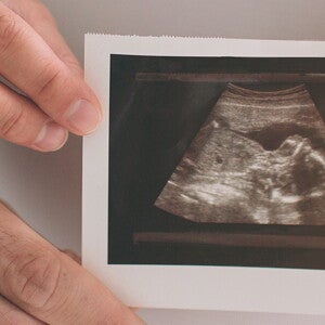 Week by week pregnancy calendar