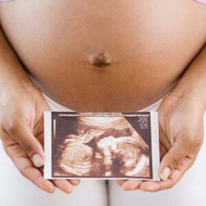 Expectation at 5 month of pregnancy